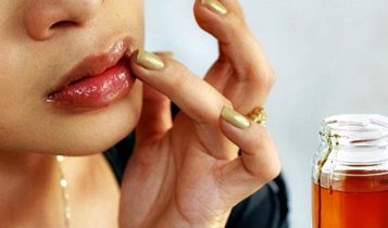 Môi khô, nứt môi nên bôi gì?