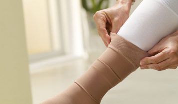 Thể dục chữa bệnh suy giãn tĩnh mạch