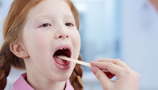 Viêm amidan có bị lây không?