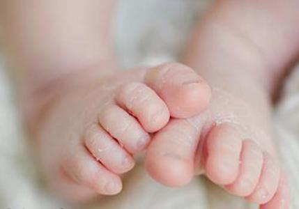 Đừng để bé bị khô da