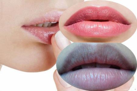 Mẹo hay xóa mờ môi thâm