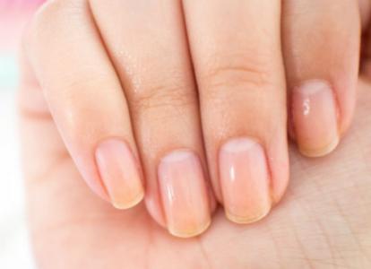 Màu móng tay cho biết tình hình sức khỏe của bạn