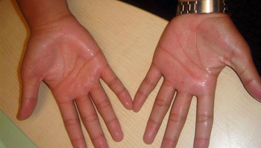 Cách chữa rối loạn thần kinh thực vật và một số điều cần lưu ý