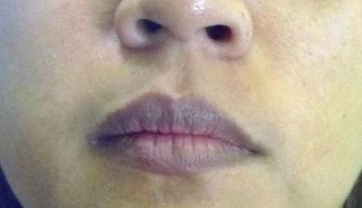 Bộ phận trên cơ thể phụ nữ thâm đen chứng tỏ tử cung rất xấu, đi khám ngay