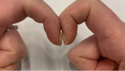 Lá phổi của bạn khỏe mạnh hay suy yếu bằng cách đặt 2 đầu ngón tay trỏ sát nhau