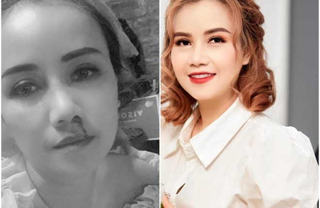 Những sao Việt bị chồng bạo hành