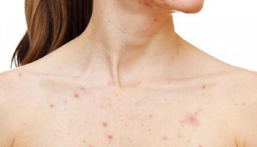 một số Mẹo đơn giản giúp 