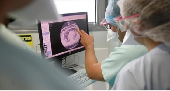 Virus nCoV còn làm tổn thương tới 6 bộ phận khác: Ai cũng phải cẩn thận