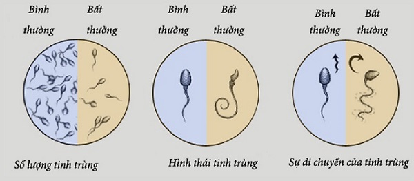 Mắc COVID-19 ảnh hưởng như thế nào đến chất lượng tinh trùng?