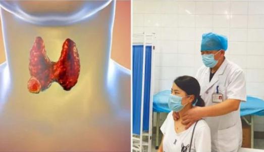 3 bước tự kiểm tra u tuyến giáp qua gương, ai cũng làm được