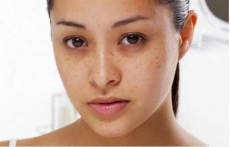 Biểu hiện ở vùng đầu cảnh báo gan lâm nguy