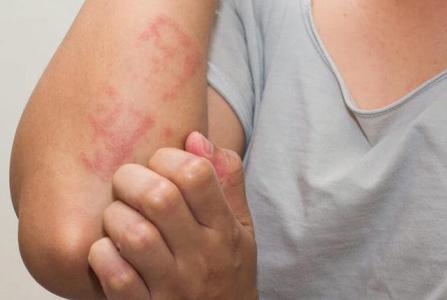 Dấu hiệu thường gặp khi chị em bị dị ứng tinh dịch