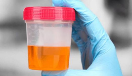 Bộ phận trên cơ thể có màu vàng chứng tỏ dễ đoản thọ, mọi người nên biết