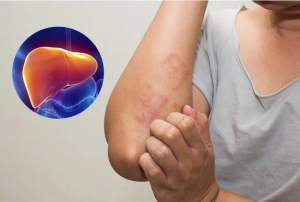 4 vùng cơ thể đau cảnh báo bệnh gan đã đi vào giai đoạn nặng