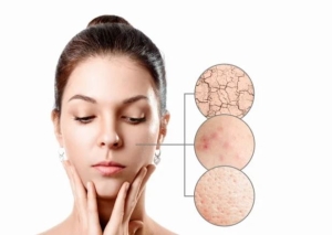 Loại mặt nạ cải thiện tình trạng da bị khô sần, thô ráp