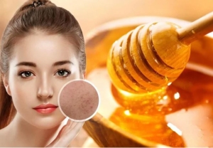 Cách làm đẹp từ mật ong giúp đánh bay mụn
