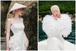 Người mẫu bạch tạng Quỳnh Ngô trong BST 