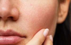 Mẹo trị lỗ chân lông to để làn da bạn thêm mịn màng