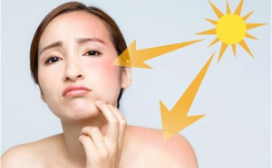 Da bạn thích hợp với loại nào hơn: kem chống nắng vật lý và kem chống nắng hóa học?