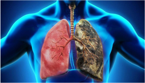 Một điểm trên mũi, Nhìn biết ngay phổi có sạch hay dính đầy cặn bẩn