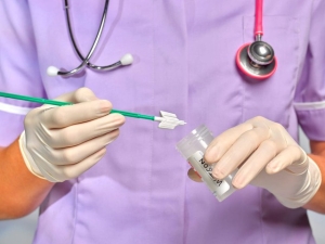 Nghi ngờ ung thư cổ tử cung 3 dấu hiệu bất thường ở âm đạo