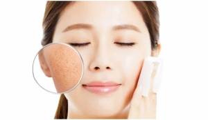 mẹo đơn giản và dễ thực hiện giúp bạn thoát khỏi tình trạng lỗ chân lông to