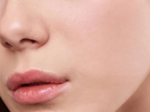 Cách giải quyết tình trạng da khô bong tróc quanh mép mùa hanh khô