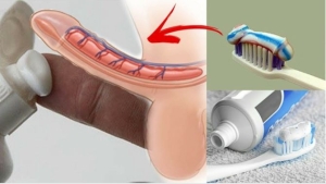 Bôi kem đánh răng chống xuất tinh sớm có hiệu quả không?