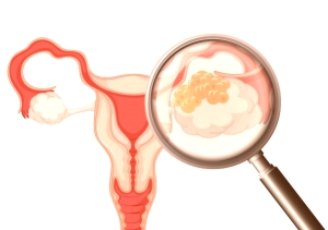 Chảy máu thời điểm rụng trứng có đáng lo ngại?