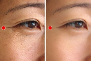 Mách nàng những mẹo đơn giản để ngăn ngừa vết chân chim