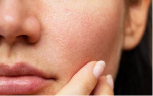 Mẹo đơn giản giúp khắc phục tình trạng lỗ chân lông ngày càng to