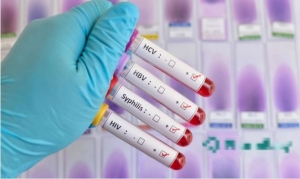 Các loại bệnh lây truyền qua đường tình dục thường gặp nhất