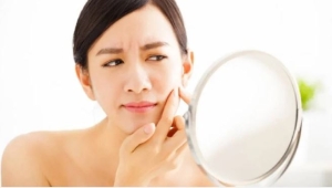 Cách trị mụn đầu đen tại nhà dễ tìm và an toàn