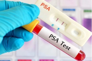 Dấu hiệu cảnh báo ung thư tuyến tiền liệt