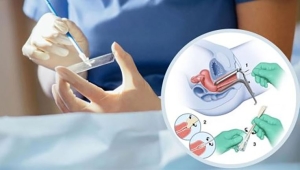 Cách tốt nhất để phát hiện sớm ung thư cổ tử cung