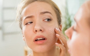 Da khô điều trị mụn mãi không khỏi do đâu?