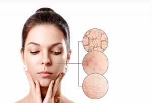 Nguyên tắc “sáng C – tối A” hồi sinh làn da