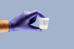 Bạn cần biết. Tinh dịch đổi màu: Dấu hiệu bệnh lý không thể chủ quan