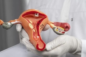 Tắc vòi trứng gây cản trở khả năng thụ thai tự nhiên