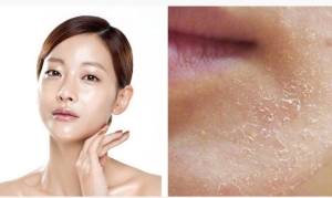 Giúp bạn 6 dấu hiệu khiến gương mặt trông già hơn tuổi và cách cải thiện hiệu quả