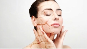 Cách bảo vệ và phục hồi da đúng cách khi nắng nóng đỉnh điểm khiến da dễ cháy nắng