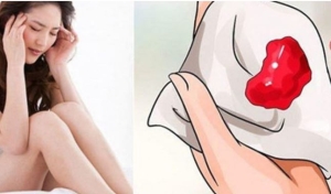 Khi nào cần đi khám. Kinh nguyệt có cục máu đông có bình thường không