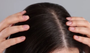 5 cách giúp tóc lâu bết, da đầu sạch khỏe trong mùa nóng